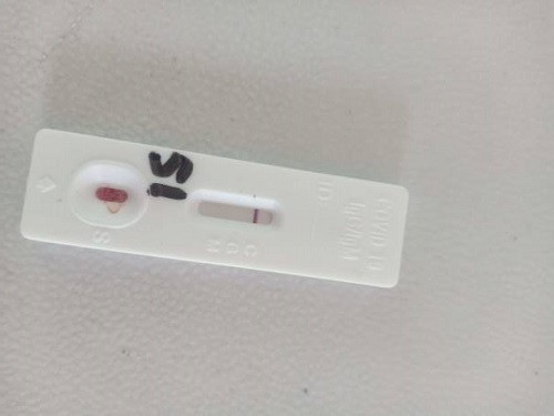 تصویر 1 از خرید و قیمت کیت تشخیص هاری + فروش عمده